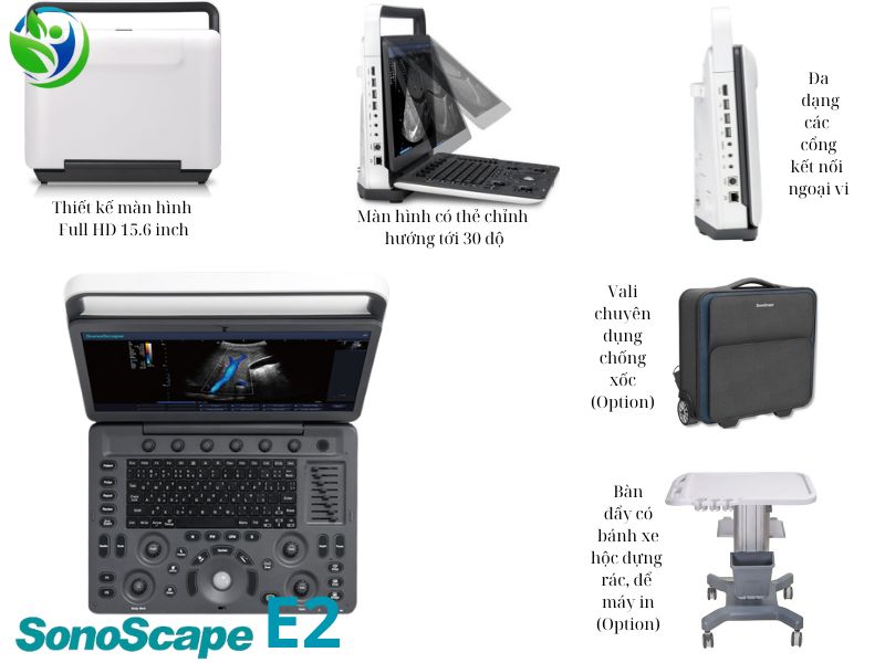 Máy siêu âm SonoScape E2 tim, màn hình 15.6inch CW, PW, SR Flow, Vis-Needle, TDI